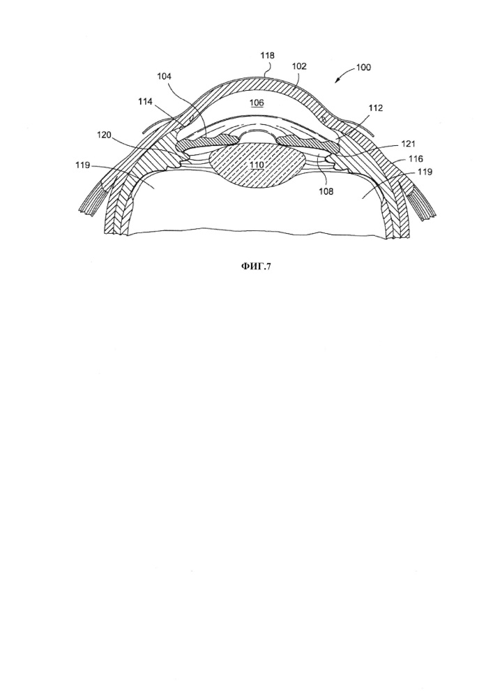 Внутриглазные имплантаты, содержащие простамид, и способы их применения (патент 2650614)