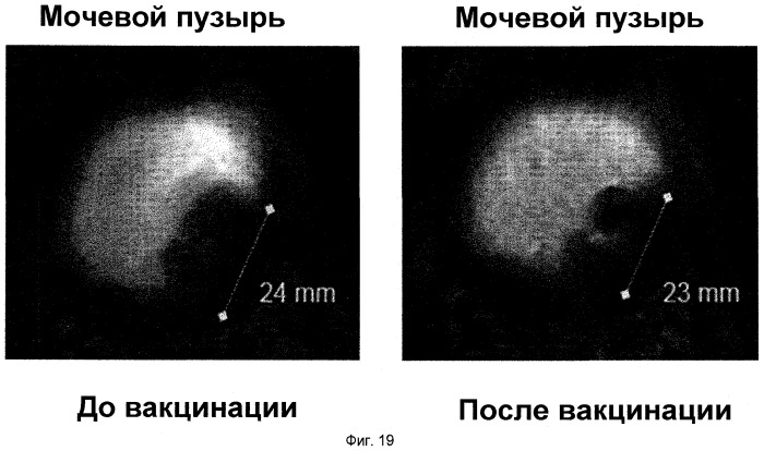 Пептидные вакцины против рака с экспрессией полипептидов mphosph1 или depdc1 (патент 2469044)