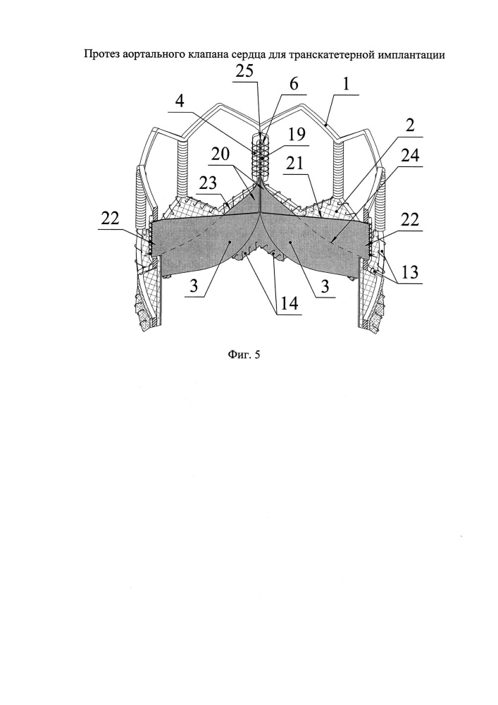 Протез аортального клапана сердца для транскатетерной имплантации (патент 2634418)