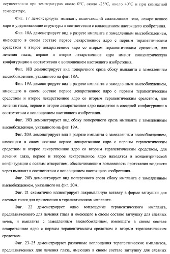 Лекарственные ядра для замедленного высвобождения терапевтических средств (патент 2478366)