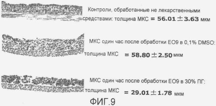 Лечение рака мочевого пузыря с использованием ео9 и пропиленгликоля (патент 2396953)