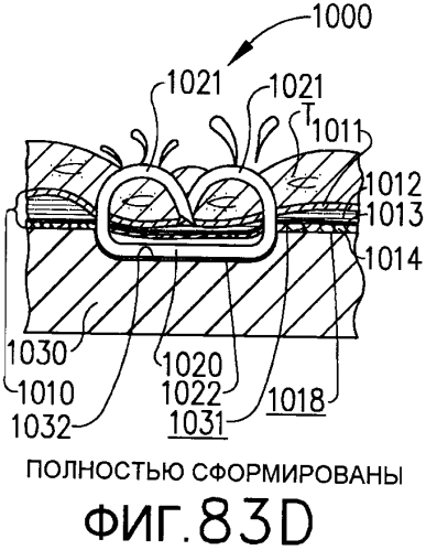 Избирательно ориентируемый имплантируемый сшивающий картридж (патент 2575671)