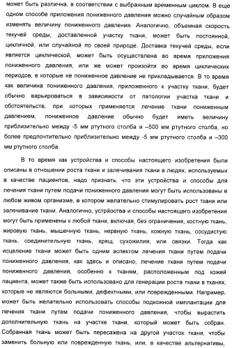 Устройство для лечения путем подкожной подачи пониженного давления с использованием разделения с помощью воздушного баллона (патент 2401652)