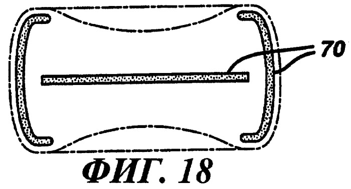 Составная гигиеническая прокладка (варианты) (патент 2253426)