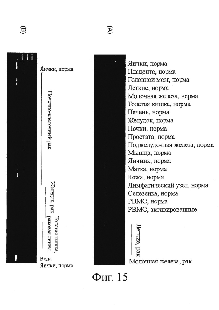 Идентификация опухолеассоциированных антигенов для диагностики и терапии (патент 2644686)