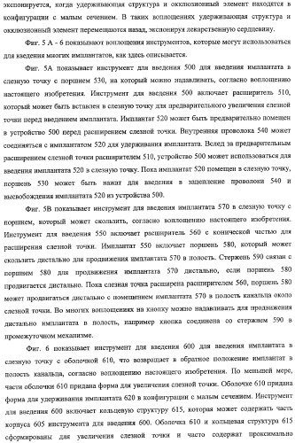 Способы доставки лекарственных средств, структуры и композиции для носослезной системы (патент 2413480)