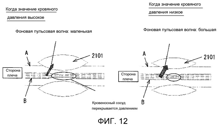 Электронный сфигмоманометр и способ измерения кровяного давления (патент 2521349)