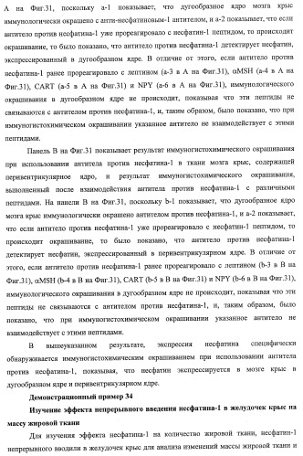 Способ получения фактора, связанного с контролем над потреблением пищи и/или массой тела, полипептид, обладающий активностью подавления потребления пищи и/или прибавления в весе, молекула нуклеиновой кислоты, кодирующая полипептид, способы и применение полипептида (патент 2418002)