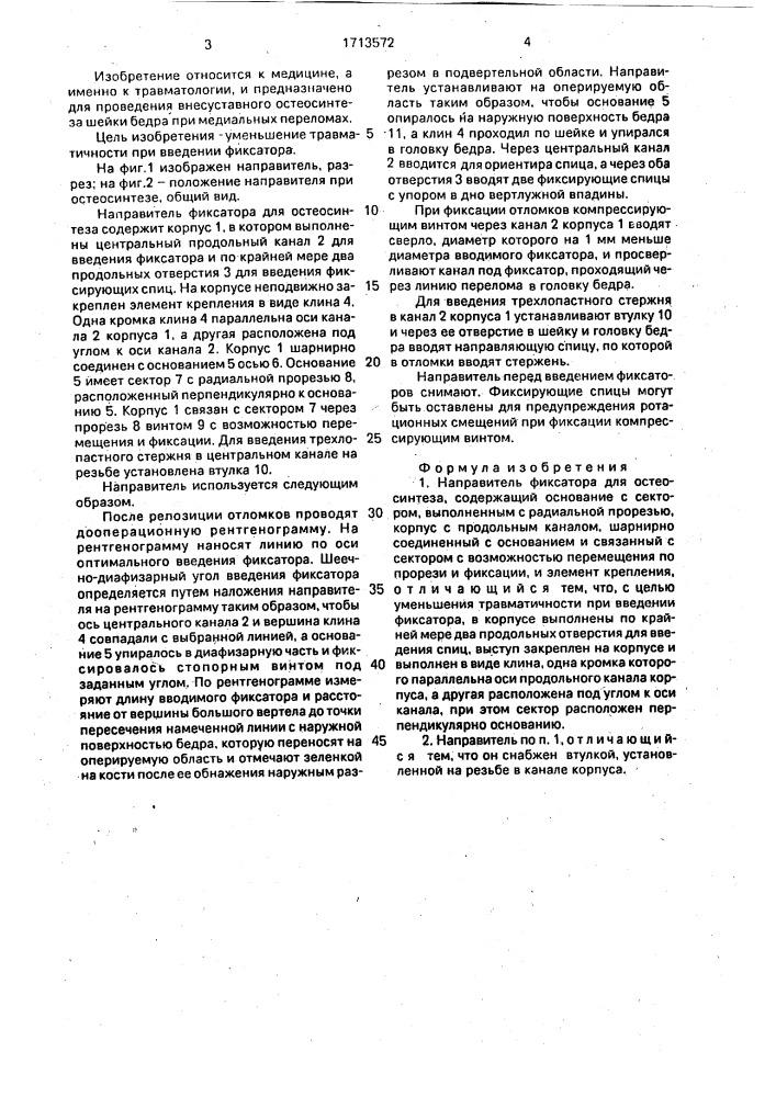 Направитель фиксатора для остеосинтеза (патент 1713572)