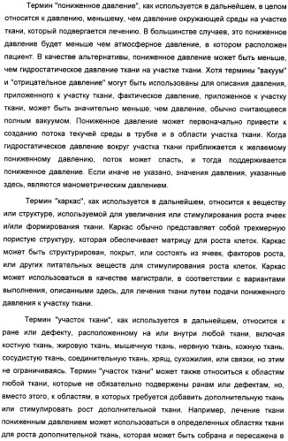 Устройство для лечения путем подкожной подачи пониженного давления с использованием текучей магистрали и связанный с ним способ (патент 2405459)