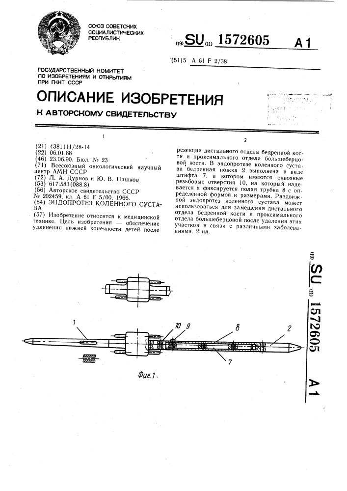 Эндопротез коленного сустава (патент 1572605)