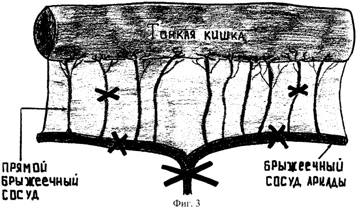 Способ определения кровонасыщения биологических тканей в условиях ишемии на модели тонкой кишки (патент 2276792)