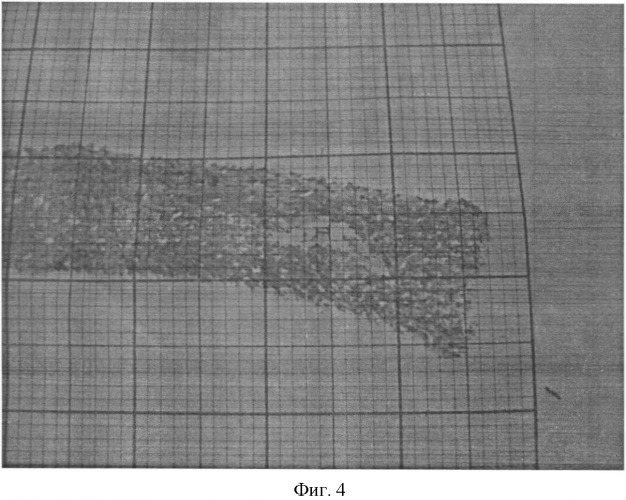 Способ определения линейных размеров и площади поверхностной проекции атрофического рубца кожи (патент 2443391)