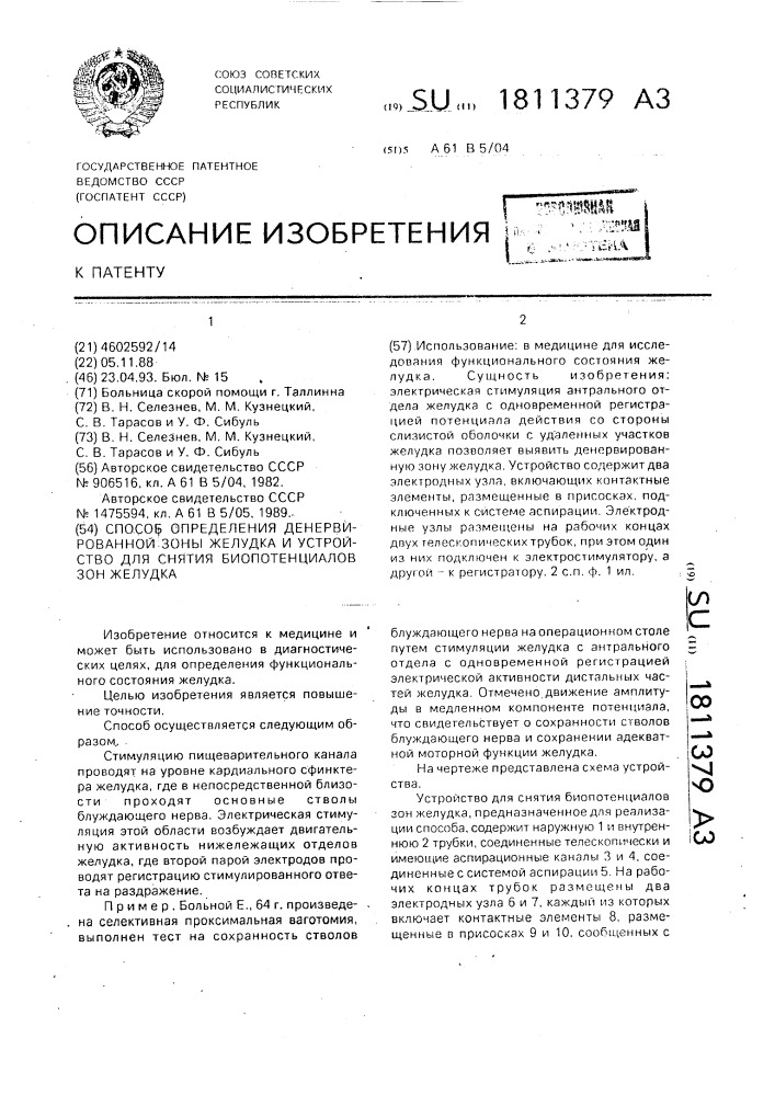 Способ определения денервированной зоны желудка и устройство для снятия биопотенциалов зон желудка (патент 1811379)