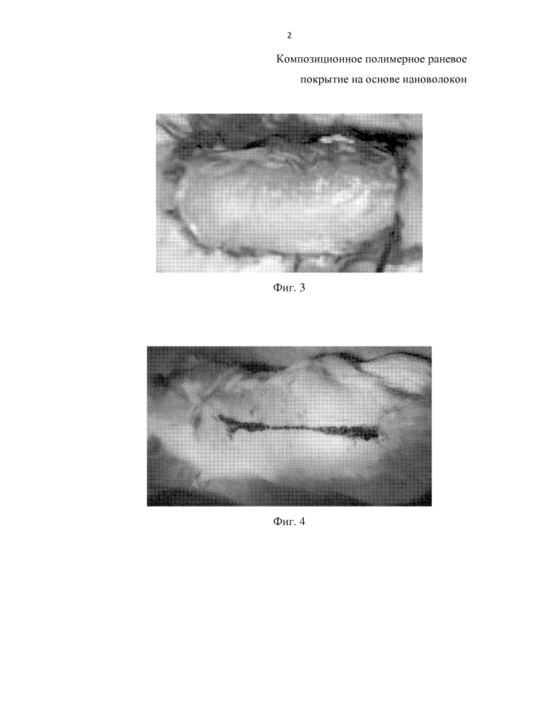 Композиционное полимерное раневое покрытие на основе нановолокон (патент 2647609)