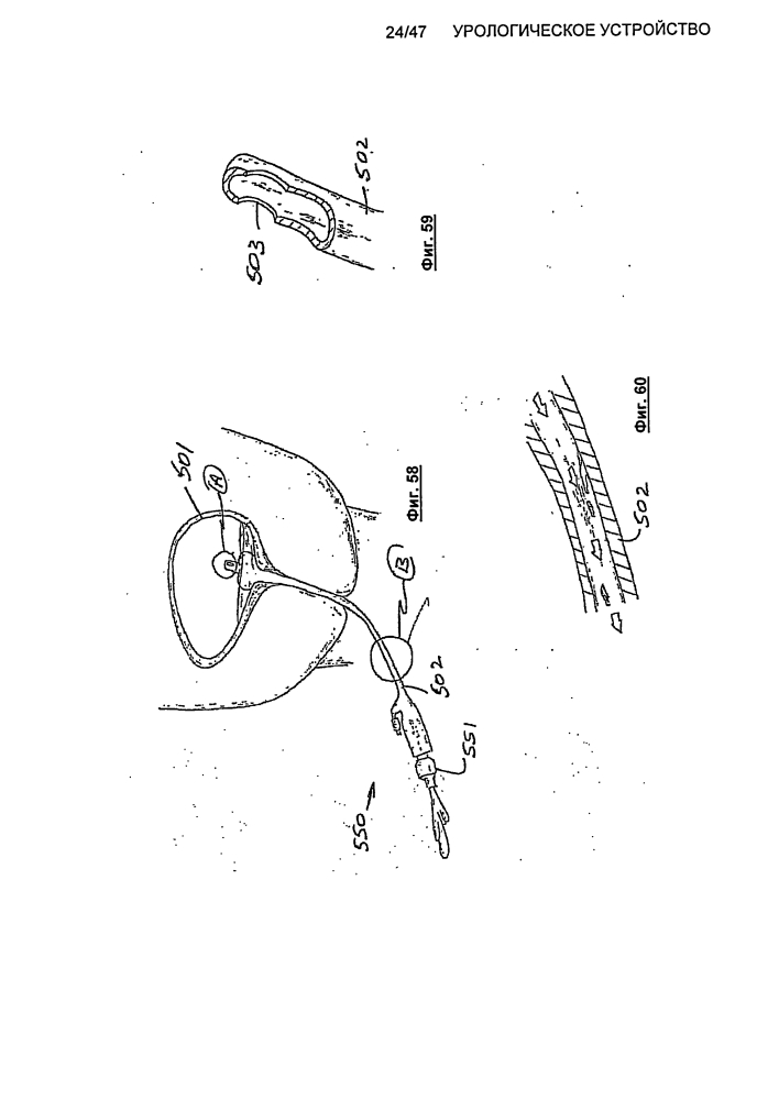 Урологическое устройство (патент 2600865)