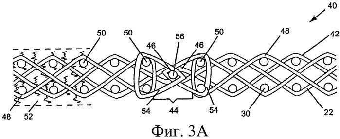 Сшиваемая на машине техническая ткань с кольцами для усиления шва (патент 2320793)