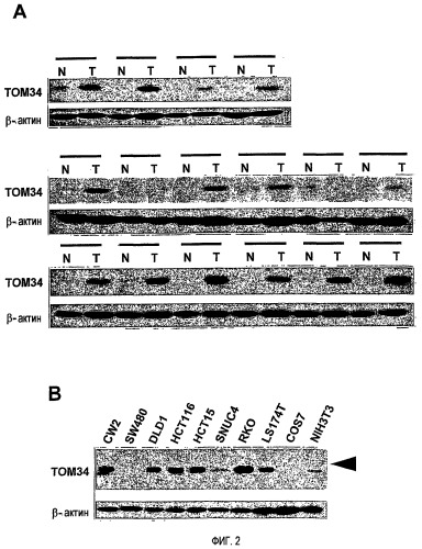 Связанный с раком толстого кишечника ген том34 (патент 2449020)