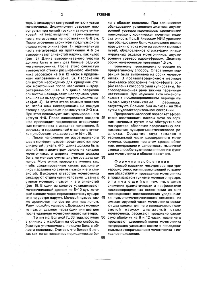 Способ пластики мегауретера при уретероцистонеостомии (патент 1725845)