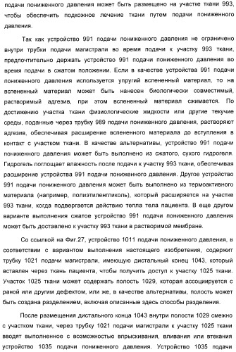 Устройство для лечения путем подкожной подачи пониженного давления с использованием разделения с помощью воздушного баллона (патент 2401652)