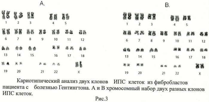 Способ получения индуцированных плюрипотентных стволовых клеток из фибробластов пациентов с болезнью хангингтона (патент 2458983)