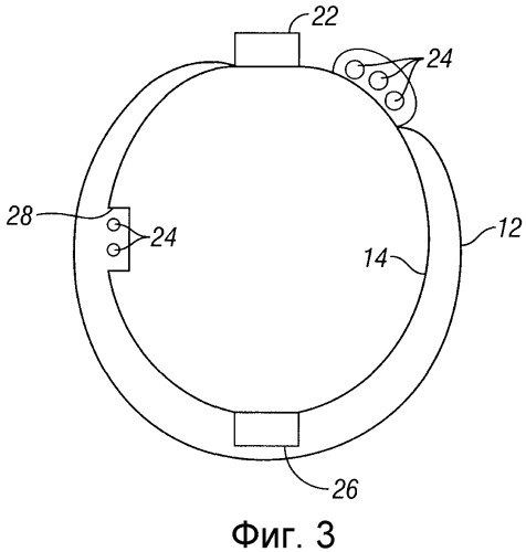 Сетчатый фильтр (варианты) и способ его изготовления (патент 2271440)