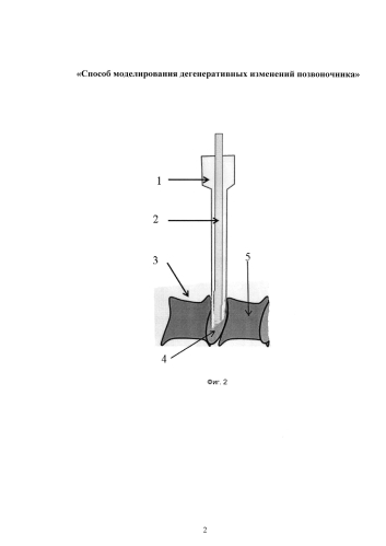 Способ моделирования дегенеративных изменений позвоночника (патент 2584136)