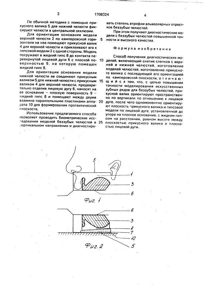 Способ получения диагностических моделей (патент 1708324)
