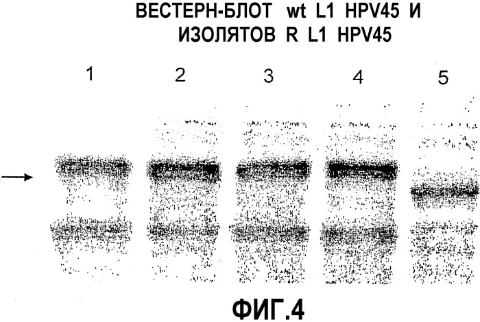 Оптимизированная экспрессия l1 hpv45 в дрожжах (патент 2360001)