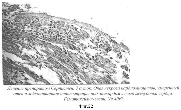 Гиполипидемическое и противоишемическое средство &quot;серпистен&quot; (патент 2337701)