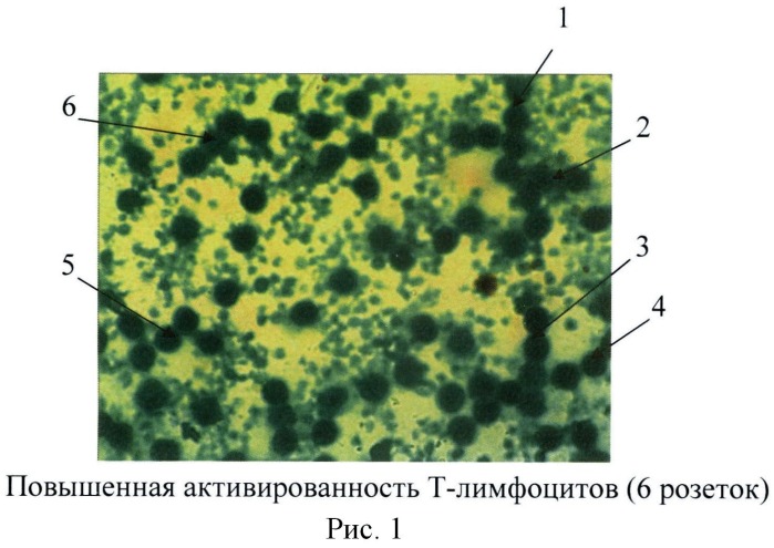 Способ выявления повышенной активированности т-лимфоцитов (патент 2502998)