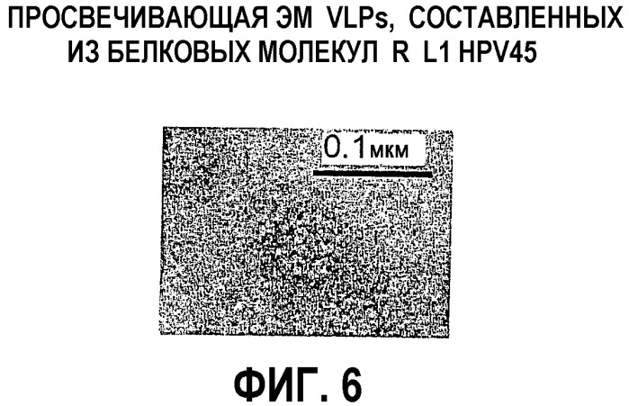 Оптимизированная экспрессия l1 hpv45 в дрожжах (патент 2360001)