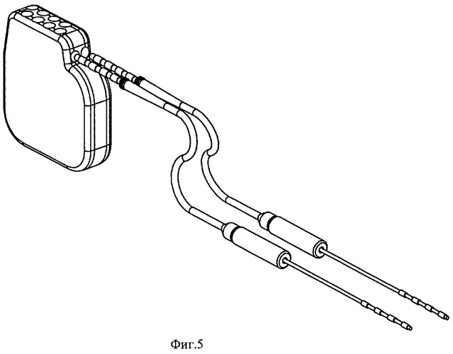 Многоканальный программируемый электронейростимулятор (патент 2286182)