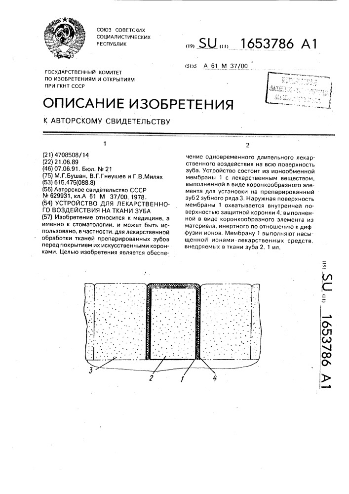 Устройство для лекарственного воздействия на ткани зуба (патент 1653786)