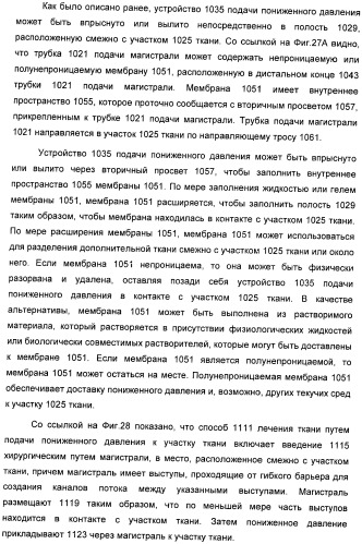 Система и способ продувки устройства пониженного давления во время лечения путем подачи пониженного давления (патент 2404822)