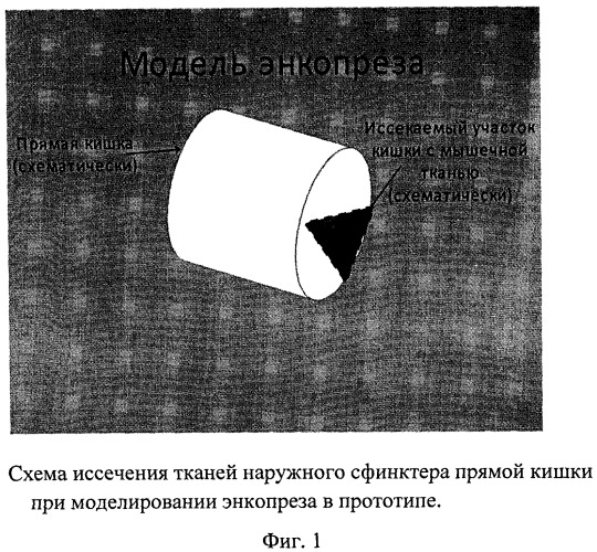 Способ создания модели энкопреза (патент 2518127)