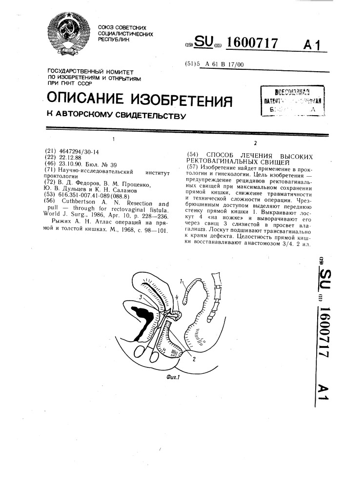 Способ лечения высоких ректовагинальных свищей (патент 1600717)