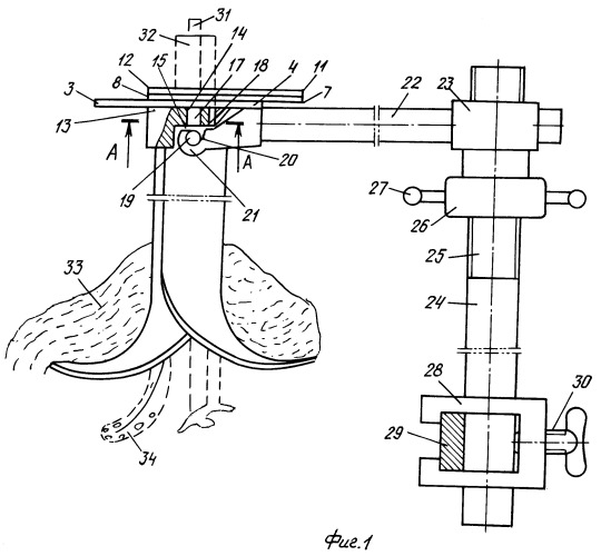 Способ и устройство лапаролифта для лапароскопических операций сменным инструментом (патент 2463966)