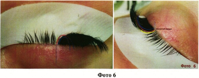 Способ наращивания ресниц "lash-to-lash" (патент 2541953)
