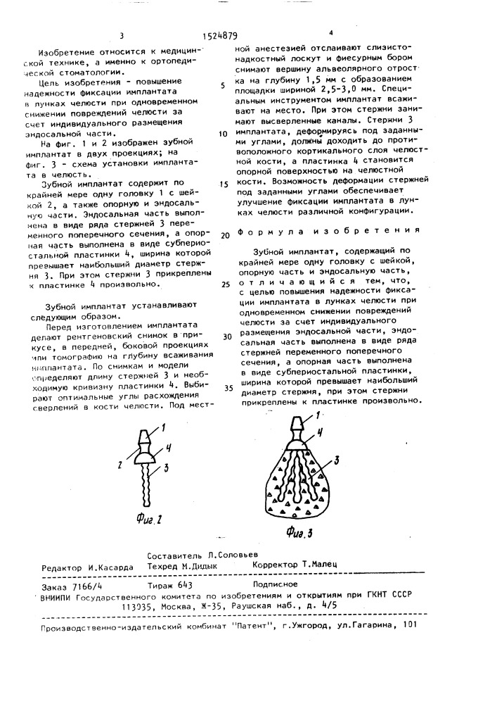 Зубной имплантат (патент 1524879)