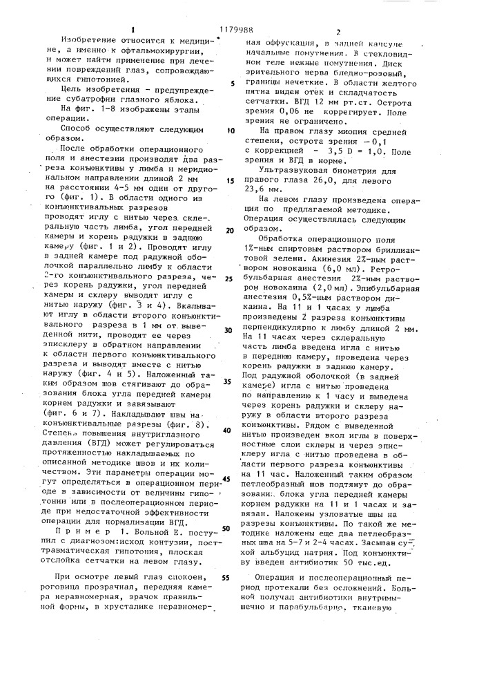 Способ лечения гипотонии глаза (патент 1179988)