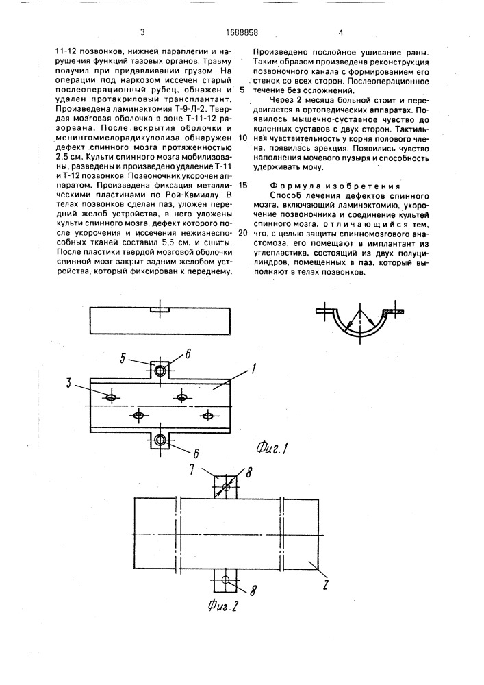 Способ лечения дефектов спинного мозга (патент 1688858)