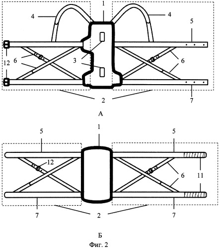 Корсет фиксирующий (патент 2284168)