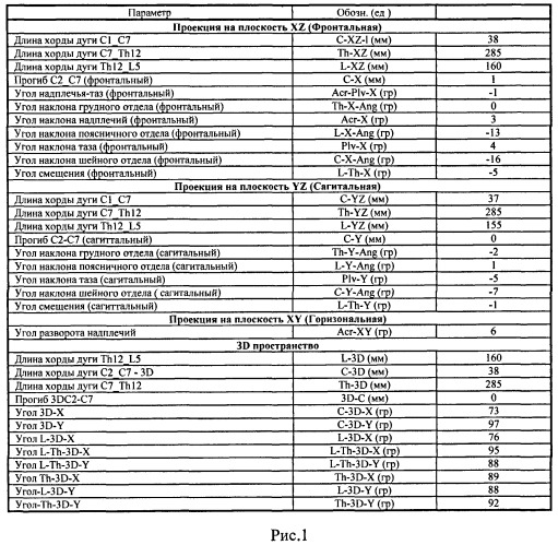 Способ оценки деформации позвоночника с использованием компьютерного комплекса &quot;3d-сканер&quot; (патент 2445919)