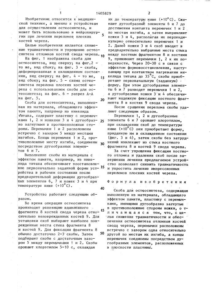 Скоба для остеосинтеза (патент 1405829)