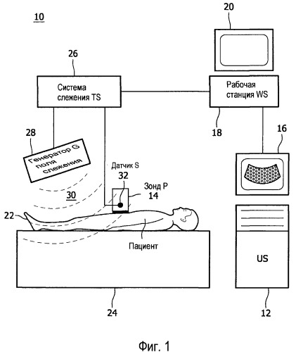 Интервенционная навигация с использованием трехмерного ультразвука с контрастным усилением (патент 2494676)