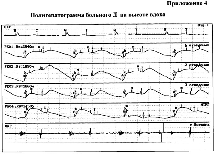 Способ и устройство для оценки гемодинамики печени (патент 2372022)