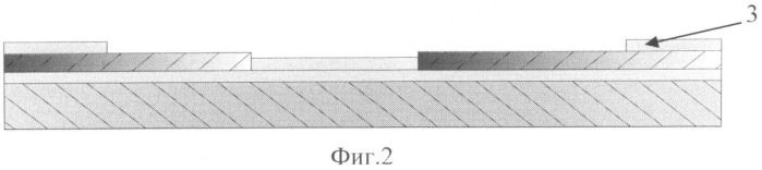 Способ коррекции топологии бис (патент 2560967)