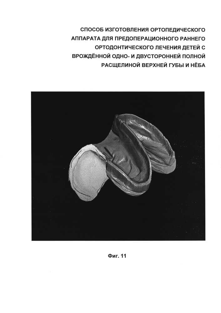 Способ изготовления ортопедического аппарата для предоперационного раннего ортодонтического лечения детей с врождённой одно- и двусторонней полной расщелиной верхней губы и нёба (патент 2599373)