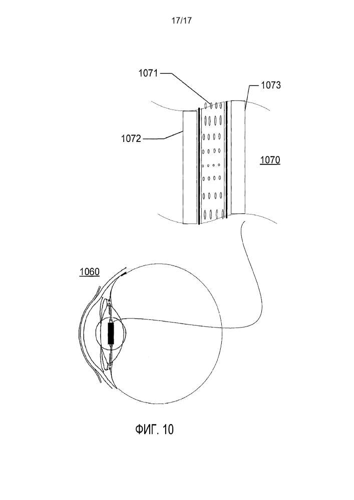 Способы и устройство для офтальмологических устройств, включающих в себя циклоидально ориентированные жидкокристаллические слои (патент 2596883)